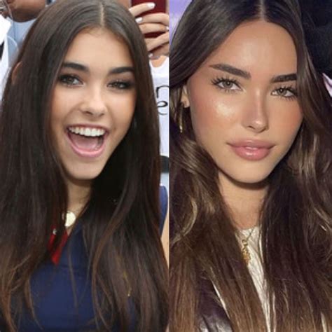 madison beer before plastic|Madison Beer Denies Plastic Surgery Rumors, But Heres What。